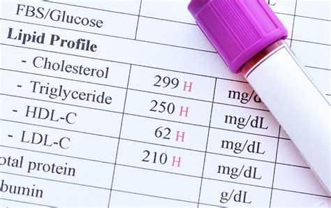 n lab test|Lab Test Results: What to Expect .